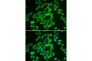 Immunofluorescence analysis of HeLa cells using CSNK1E antibody (ABIN6128970, ABIN6139116, ABIN6139117 and ABIN7101448).