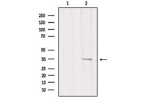 Western blot analysis of extracts from 293, using MSHR Antibody. (MC1 Receptor antibody  (C-Term))