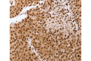 Immunohistochemistry (IHC) image for anti-Pituitary Tumor-Transforming 1 (PTTG1) antibody (ABIN2426368) (PTTG1 antibody)
