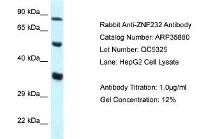 WB Suggested Anti-ZNF232 Antibody   Titration: 1. (ZNF232 antibody  (N-Term))