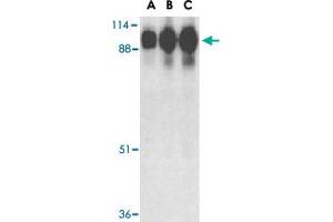 Western blot analysis of ACE2 in human kidney tissue lysate with ACE2 polyclonal antibody  at (A) 0. (ACE2 antibody  (Internal Region))