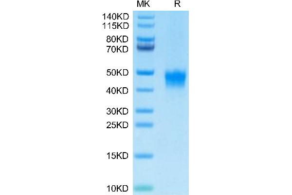 DKK1 Protein (AA 32-266) (His-Avi Tag,Biotin)