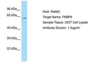 Image no. 1 for anti-FK506 Binding Protein 9, 63 KDa (FKBP9) (C-Term) antibody (ABIN6750098)