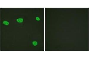 Immunofluorescence analysis of HeLa cells, using Vitamin D Receptor (Ab-208) Antibody. (Vitamin D Receptor antibody  (AA 181-230))