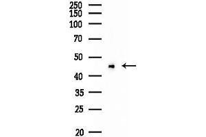 anti-Chloride Intracellular Channel 5 (CLIC5) antibody
