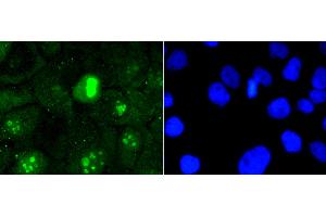Immunofluorescence analysis of A431 cells using MKI67 antibody (ABIN5997055).