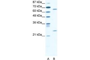 WB Suggested Anti-FOXK2 Antibody Titration:  2. (Forkhead Box K2 antibody  (C-Term))