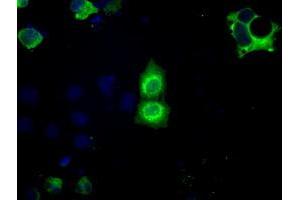 Image no. 5 for anti-Basigin (Ok Blood Group) (BSG) antibody (ABIN1498015) (CD147 antibody)