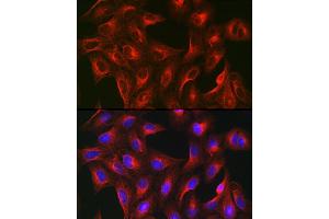 Immunofluorescence analysis of U-2 OS cells using α-Tubulin Mouse mAb (ABIN7271035) at dilution of 1:100 (40x lens). (TUBA4A antibody)