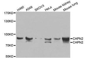 Western blot analysis of extracts of various cell lines, using CAPN2 antibody. (Calpain 2 antibody  (AA 350-680))