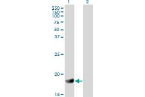 Western Blot analysis of RGS3 expression in transfected 293T cell line by RGS3 monoclonal antibody (M01), clone 1E8-C7. (RGS3 antibody  (AA 1-192))