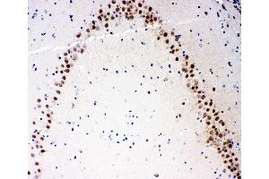 Anti-MEKK3 antibody, IHC(P) IHC(P): Rat Brain Tissue (MAP3K3 antibody  (N-Term))