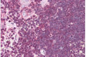 Human Thymus (formalin-fixed, paraffin-embedded) stained with ALOX5 antibody ABIN214074 at 10 ug/ml followed by biotinylated goat anti-rabbit IgG secondary antibody ABIN481713, alkaline phosphatase-streptavidin and chromogen. (ALOX5 antibody  (AA 130-149))