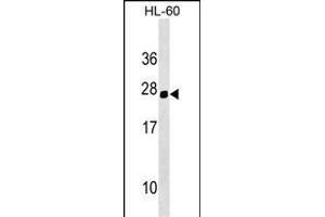 Mouse Hoxc5 Antibody (C-term) (ABIN1536714 and ABIN2849346) western blot analysis in HL-60 cell line lysates (35 μg/lane). (Homeobox C5 antibody  (C-Term))