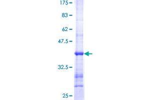 SEMA3C Protein (AA 653-751) (GST tag)