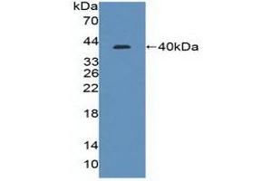 Detection of Recombinant IRF8, Human using Polyclonal Antibody to Interferon Regulatory Factor 8 (IRF8) (IRF8 antibody  (AA 128-426))