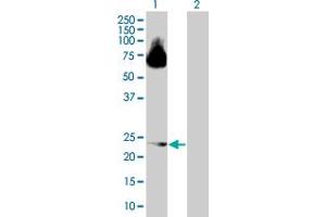 Western Blot analysis of ARL4D expression in transfected 293T cell line by ARL4D MaxPab polyclonal antibody. (ARL4D antibody  (AA 1-201))