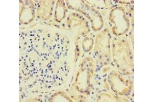Immunohistochemistry of paraffin-embedded human kidney tissue using ABIN7170610 at dilution of 1:100 (SPIN4 antibody  (AA 1-249))