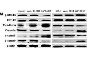 Western Blotting (WB) image for anti-Actin, beta (ACTB) (AA 1-50) antibody (ABIN724340)