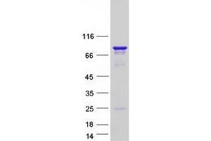 Coiled-Coil Domain Containing 9 (CCDC9) protein (Myc-DYKDDDDK Tag)