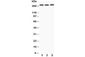 Western blot testing of NOTCH4 antibody and Lane 1:  A549;  2: SMMC-7721;  3: HeLa. (NOTCH4 antibody  (C-Term))