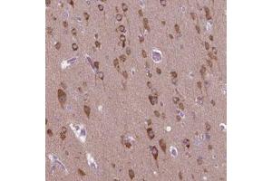 Immunohistochemical staining (Formalin-fixed paraffin-embedded sections) of human cerebral cortex with GAS7 polyclonal antibody  shows cytoplasmic positivity in neurons. (GAS7 antibody)