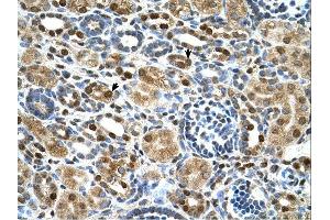ZNF169 antibody was used for immunohistochemistry at a concentration of 4-8 ug/ml. (ZNF169 antibody  (Middle Region))