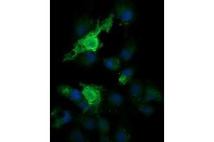 Image no. 4 for anti-Parvin, alpha (PARVA) antibody (ABIN1496443) (Parvin alpha antibody)