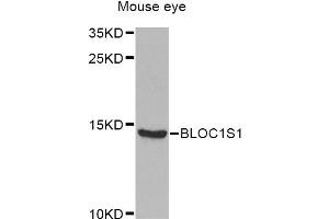 Western blot analysis of extracts of mouse eye, using BLOC1S1 Antibody (ABIN2561427) at 1:1000 dilution. (BLOC1S1 antibody)