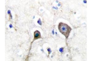 Image no. 1 for anti-S100 Calcium Binding Protein A1 (S100A1) antibody (ABIN271809) (S100A1 antibody)