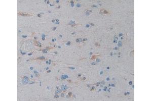 Used in DAB staining on fromalin fixed paraffin- embedded Kidney tissue