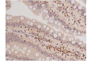 ABIN6269133 at 1/200 staining Rat intestinal tissue sections by IHC-P. (KIT antibody  (Internal Region))