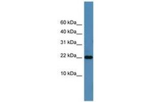 Image no. 1 for anti-SFRS12-Interacting Protein 1 (SFRS12IP1) (N-Term) antibody (ABIN6746414)