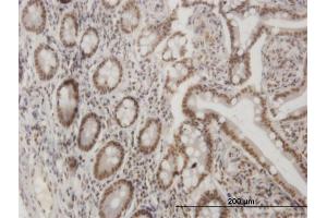 Immunoperoxidase of monoclonal antibody to LHX4 on formalin-fixed paraffin-embedded human small Intestine. (LHX4 antibody  (AA 291-390))