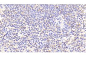 Detection of TLR8 in Human Spleen Tissue using Polyclonal Antibody to Toll Like Receptor 8 (TLR8) (TLR8 antibody  (AA 844-1039))