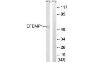 Western blot analysis of extracts from rat lung, using EFEMP1 Antibody.