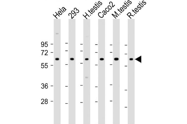 SLC2A8 antibody  (AA 260-292)