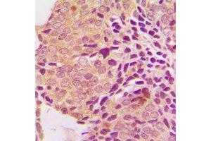 Immunohistochemistry (IHC) image for anti-Secreted Frizzled-Related Protein 4 (SFRP4) antibody (ABIN7308324) (SFRP4 antibody)