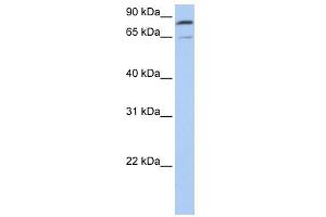 WB Suggested Anti-MFN2 Antibody Titration:  0. (MFN2 antibody  (C-Term))