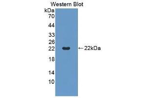 Detection of Recombinant TNFRSF5, Mouse using Polyclonal Antibody to Tumor Necrosis Factor Receptor Superfamily, Member 5 (CD40) (CD40 antibody  (AA 26-193))