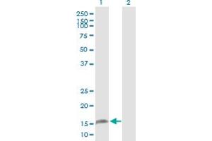 anti-Zinc Finger, Matrin-Type 4 (ZMAT4) (AA 1-153) antibody