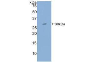 Western blot analysis of recombinant Human IL2Rg. (IL2RG antibody  (AA 23-262))