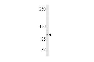 Western blot analysis of anti- in Y79 cell line lysates (35ug/lane). (ENPP2 antibody  (AA 401-430))