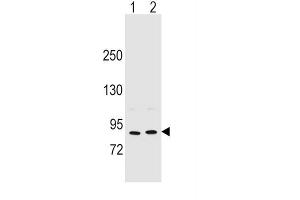 Western Blotting (WB) image for anti-Periostin (POSTN) antibody (ABIN2996464) (Periostin antibody)