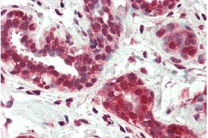 ABIN334451 (5µg/ml) staining of paraffin embedded Human Breast. (NR4A1 antibody  (Internal Region))