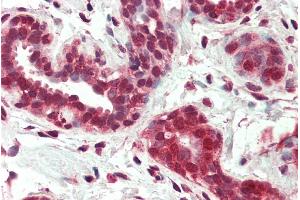 Immunohistochemistry (IHC) image for anti-Nuclear Receptor Subfamily 4, Group A, Member 1 (NR4A1) (Internal Region) antibody (ABIN334451)