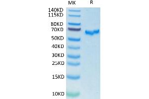 SDS-PAGE (SDS) image for SARS-CoV-2 Spike (RBD) protein (mFc Tag) (ABIN7274398)