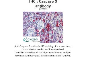 Image no. 1 for anti-Caspase 3 (CASP3) antibody (ABIN1732665) (Caspase 3 antibody)