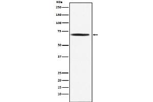 Western blot analysis of DLAT expression in Jurkat cell lysate. (Recombinant DLAT antibody)