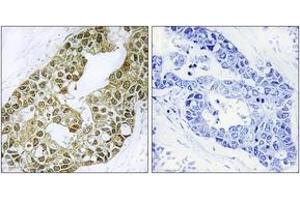 Immunohistochemistry (IHC) image for anti-Nuclear Factor of kappa Light Polypeptide Gene Enhancer in B-Cells Inhibitor, alpha (NFKBIA) (AA 9-58) antibody (ABIN1532903)